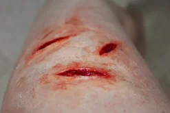 ForensicFX Studios Small Shallow Knife Stab Wounds (X3) Prosthetic><noscript><img width=