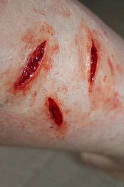 ForensicFX Studios Small Shallow Knife Stab Wounds (X3) Prosthetic><noscript><img width=