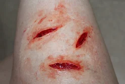 ForensicFX Studios Small Shallow Knife Stab Wounds (X3) Prosthetic><noscript><img width=