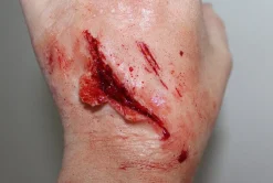 ForensicFX Studios Small Shallow Laceration Prosthetic> Halloween Accessories