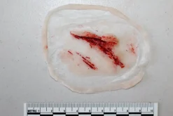 ForensicFX Studios Small Shallow Laceration Prosthetic><noscript><img width=