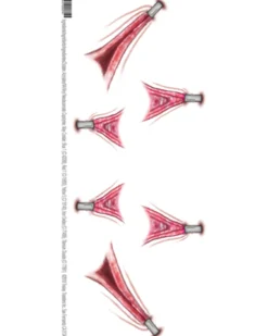 Tinsley Transfers Stretched Skin Fx Trauma Tattoo><noscript><img width=