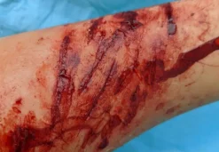 ForensicFX Studios Thin Scrapes Prosthetic> Halloween Accessories