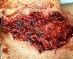 ForensicFX Studios Trauma Wounds Prosthetic Bundle> Halloween Accessories