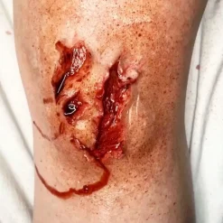 ForensicFX Studios Trauma Wounds Prosthetic Bundle><noscript><img width=