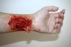 ForensicFX Studios Trauma Wounds Prosthetic Bundle><noscript><img width=