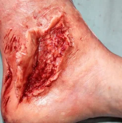 ForensicFX Studios Trauma Wounds Prosthetic Bundle><noscript><img width=