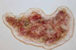 ForensicFX Studios Zombie Face Burn Prosthetic></noscript> Halloween Accessories